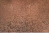 photo texture of hairy skin